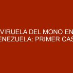 Viruela del Mono en Venezuela: primer caso detectado
